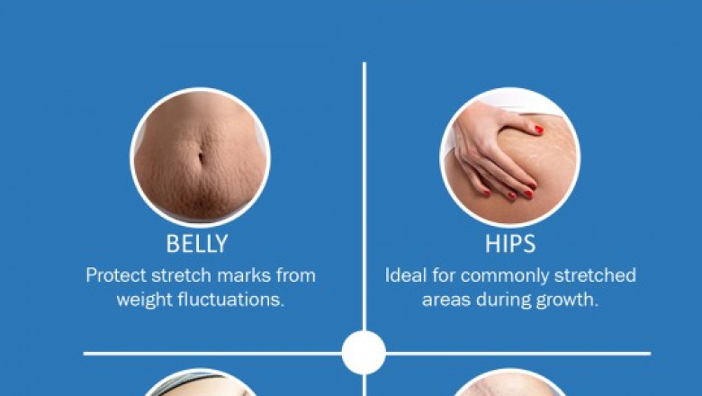 Stretch Mark Oil – Fade Scars &amp; Improve Skin Elasticity