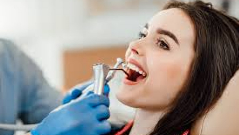 What Are the Long-Term Benefits of Full Mouth Rehabilitation?