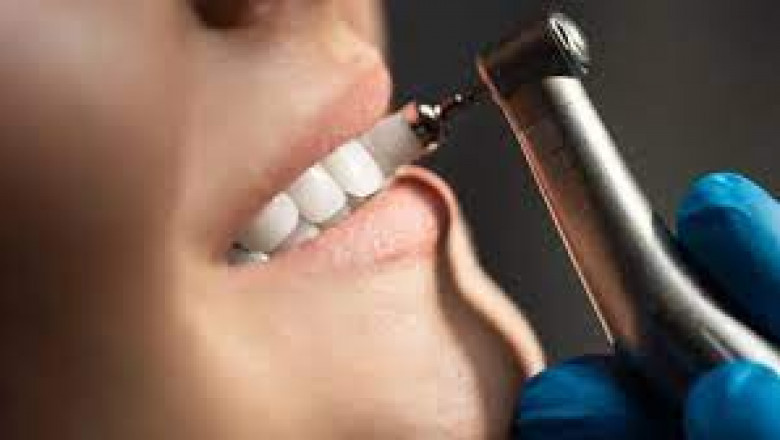 How to Choose the Right Dental Practice for Teeth Cleaning?