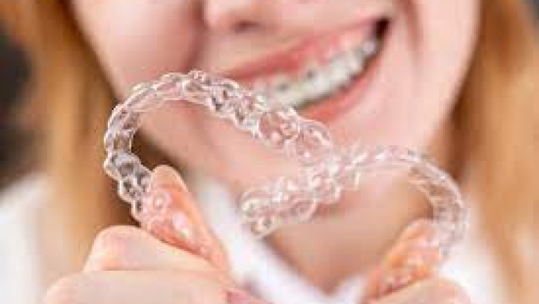 What Foods Should You Avoid During Invisalign Treatment?