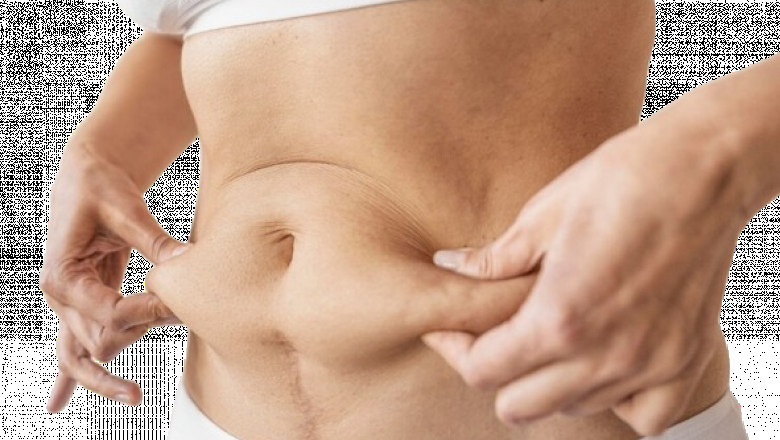 What Should I Avoid After Laser Liposuction?