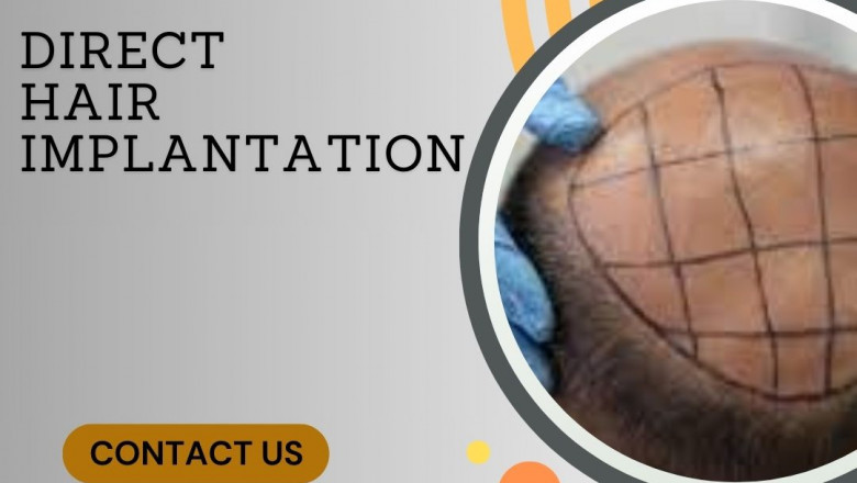 DHT Hair Transplant Bangalore | DHI Hair Transplant Cost