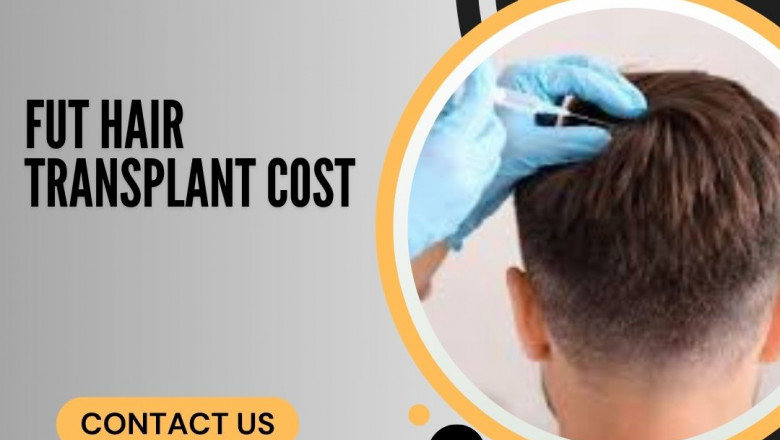 Best FUE Hair Transplant in Bangalore