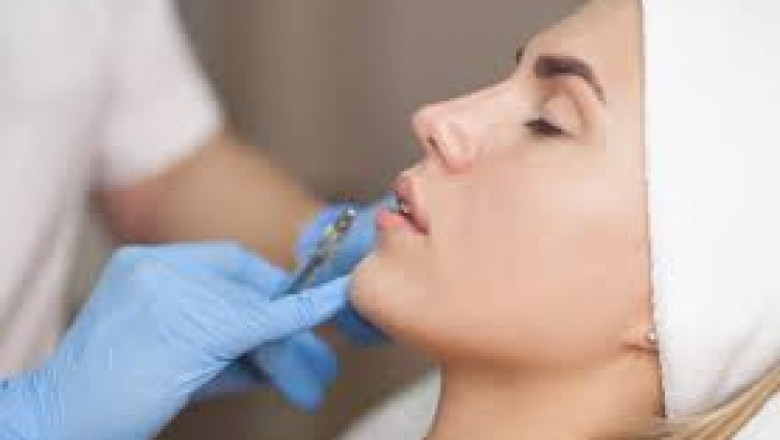 Can Dermal Fillers Be Reversed or Adjusted?