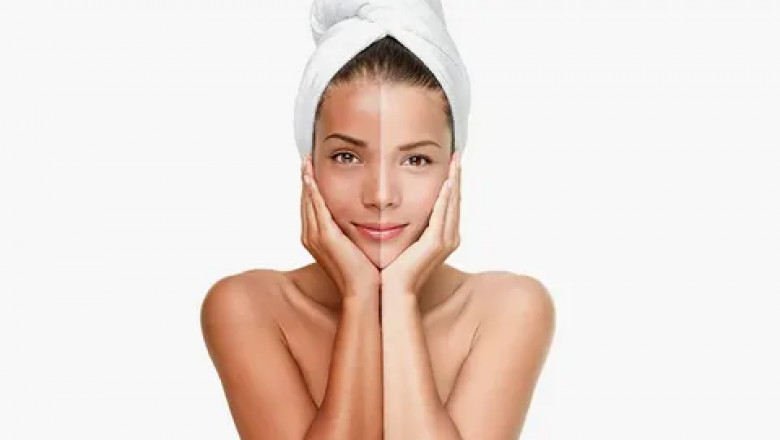 How Islamabad Clinics Personalize Skin Whitening Treatments