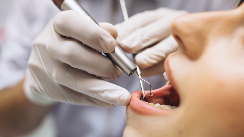 Are Dental Implants Covered by Insurance
