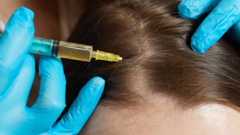 Does PRP Therapy Work for Men and Women Equally?
