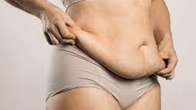 Will I Have Scars After Weight Loss Surgery?