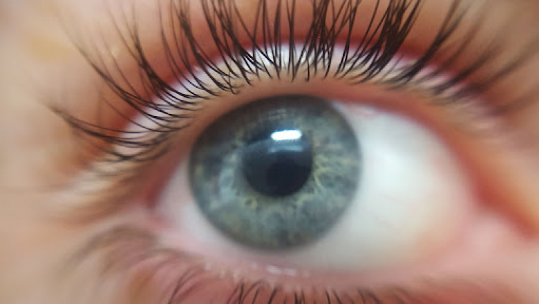 Are Eyelash Extensions Obsolete in the Age of Transplants?