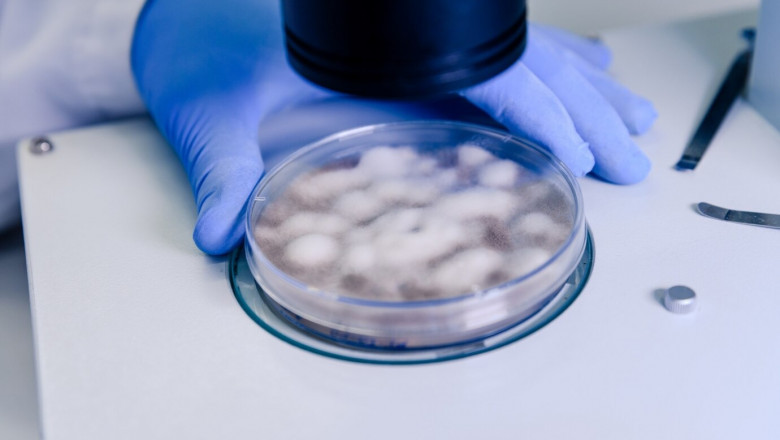 How Magnetic Protein A Beads Handle Complex Samples