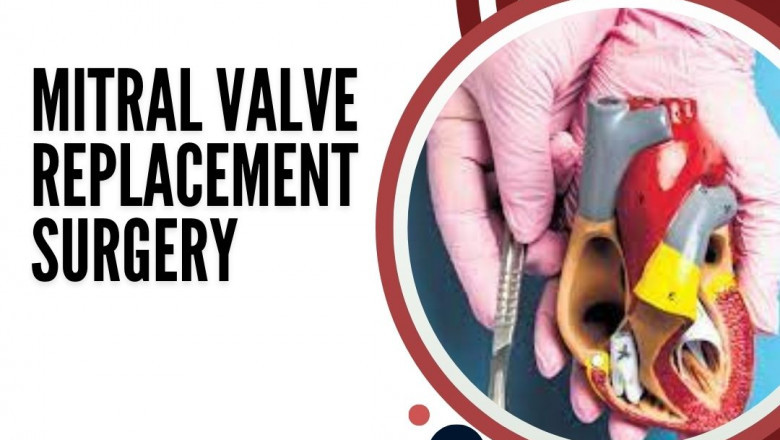 Mitral Valve Replacement Surgery Bangalore | MICS Cost
