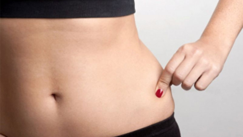 Effective Fat Reduction Treatment in Delhi at Akarabyaayna – Your Path to a Healthier You