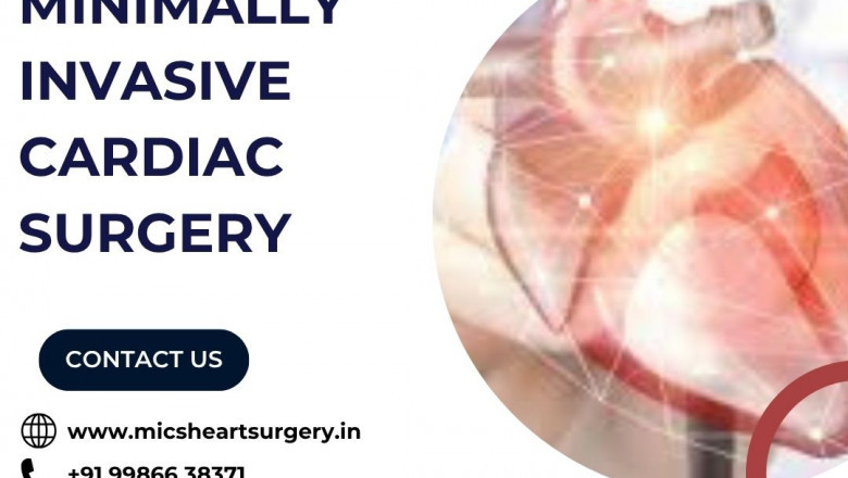 Minimally Invasive Cardiac Surgery in Bangalore