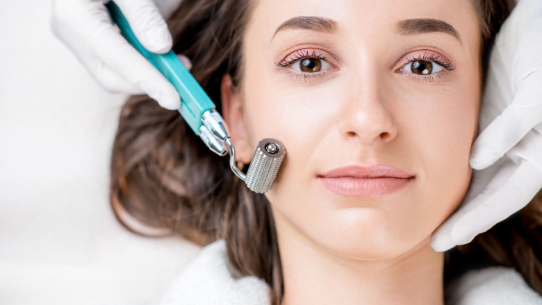 Interview with a Dermatologist in Islamabad: Is Microneedling the Future?