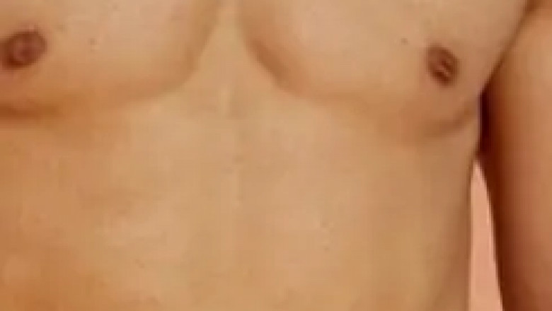 Achieve a Sculpted Look with Advanced HD Liposuction Techniques