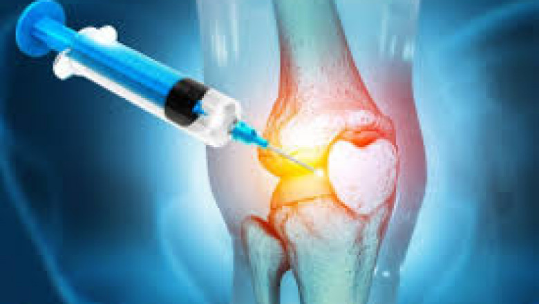 Europe Viscosupplementation Market Set to Surge with Hyaluronic Acid Innovations