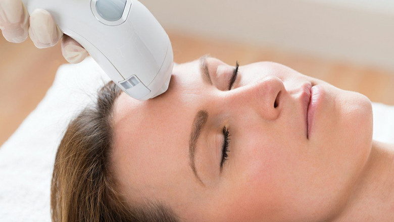 Reveal Radiant Skin with Photofacial Skin Rejuvenation in Katy at Revitalize Medi-Spa