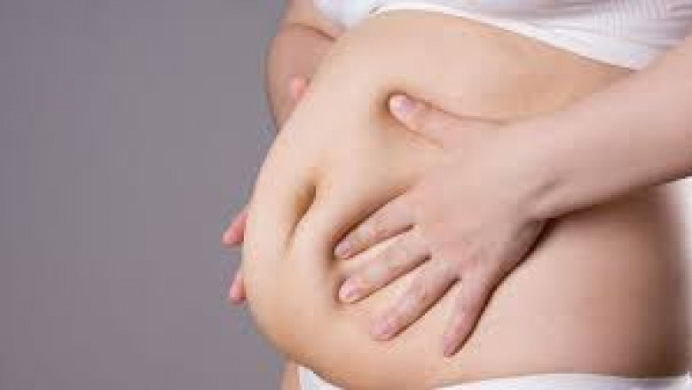 What Exercises Are Safe After Bariatric Surgery?