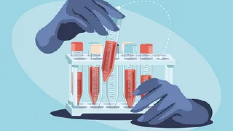 Blood Clot Retrieval Devices Market is Estimated to Grow with Robotic Thrombectomy