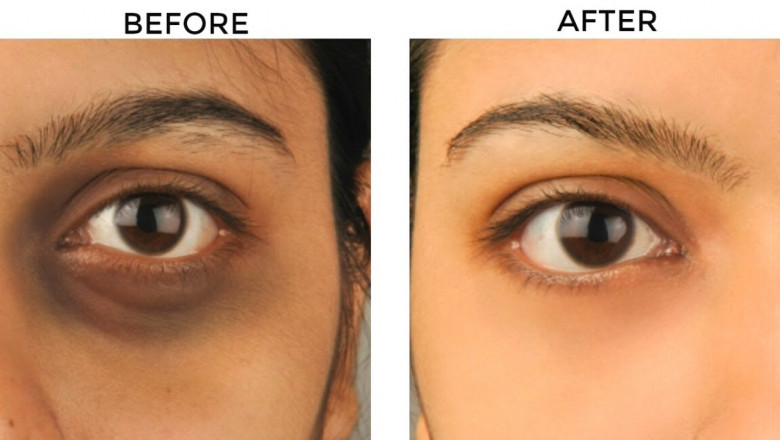 Comparing Natural Remedies vs. Clinical Treatments in Islamabad