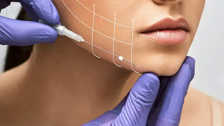 Facial Thread Lift in Dubai: How Facial Thread Lifts Compare to Traditional Facelifts