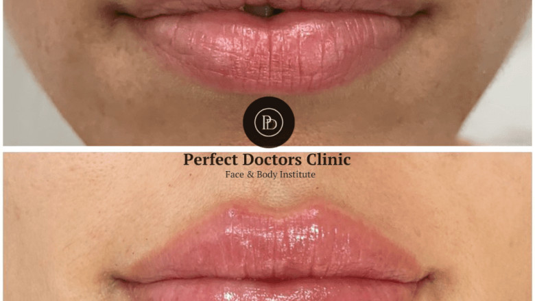 Best Aesthetic Clinics in Dubai: Can Dermal Fillers Correct Facial Volume Loss?