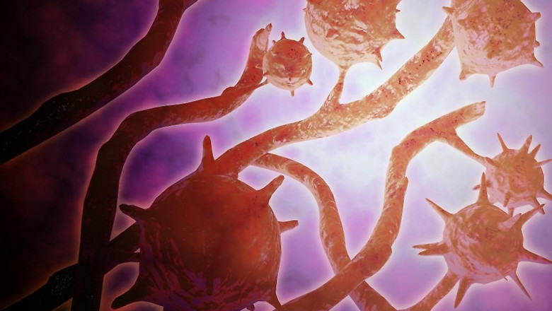 Histoplasmosis Treatment Market to Grow Fast Owing to Rising Research