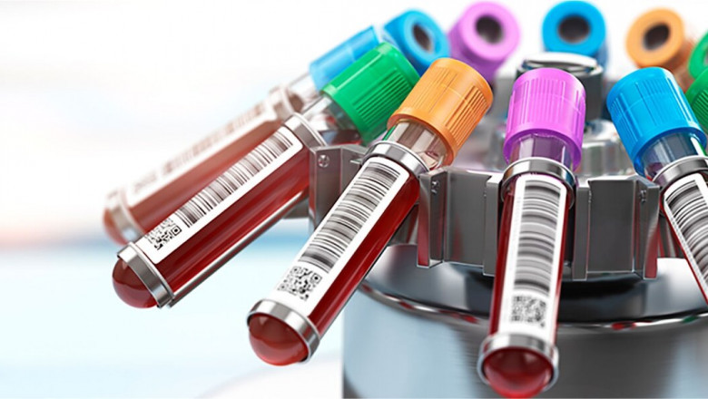 Understanding the Importance and Uses of Blood Molecular Biology Tubes in Medical Research