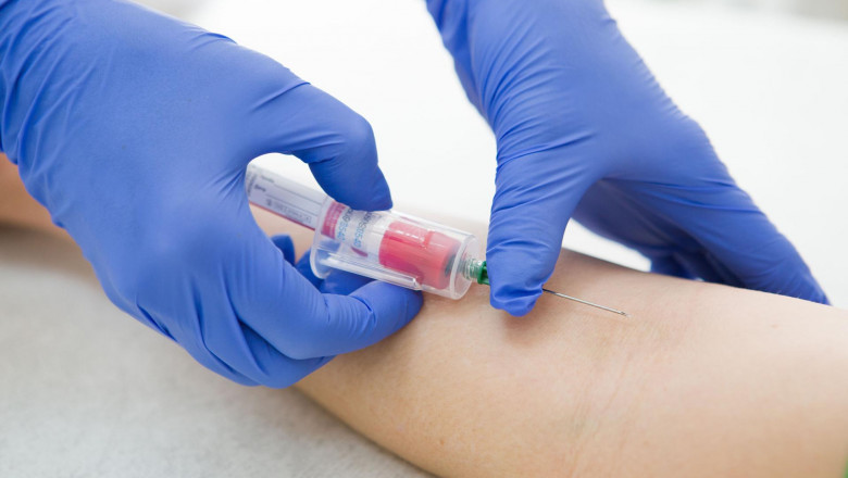 Global Compartment Syndrome Monitoring Devices Market to Grow on AI Analytics