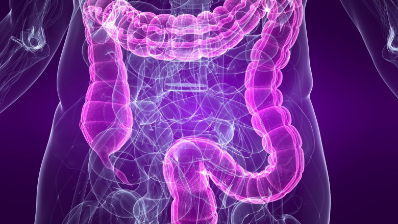 U.S. Colorectal Cancer Screening Market to Grow Rapidly with Advanced Non-Invasive Tests