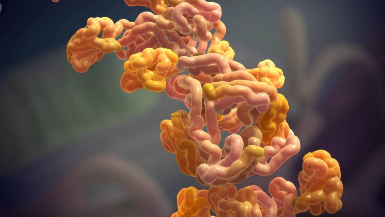 AL Amyloidosis Diagnostic Market to Grow Driven by Early Detection