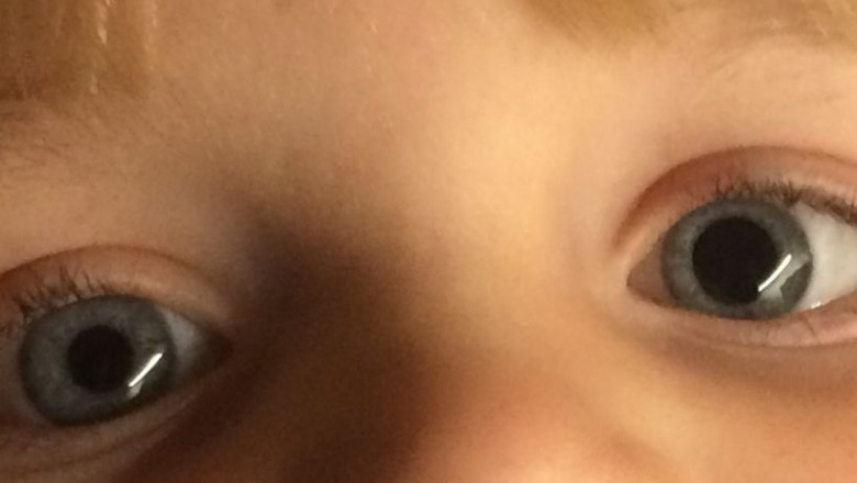 Mydriasis Treatment Market to Grow with Point-of-Care Diagnostics