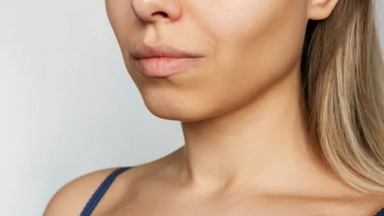 Buccal Fat Removal: Boost Your Facial Definition