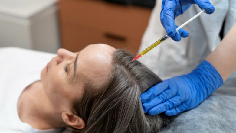 Choosing the Right PRP Doctor in Islamabad: What to Ask