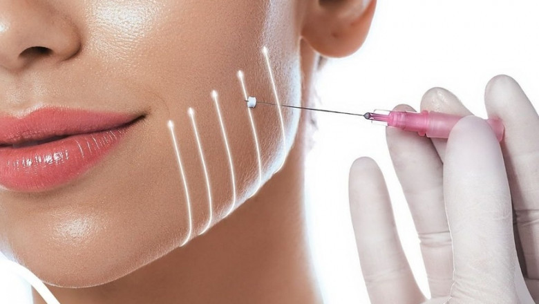 Ramadan Skin Rejuvenation: Consider a Thread Lift