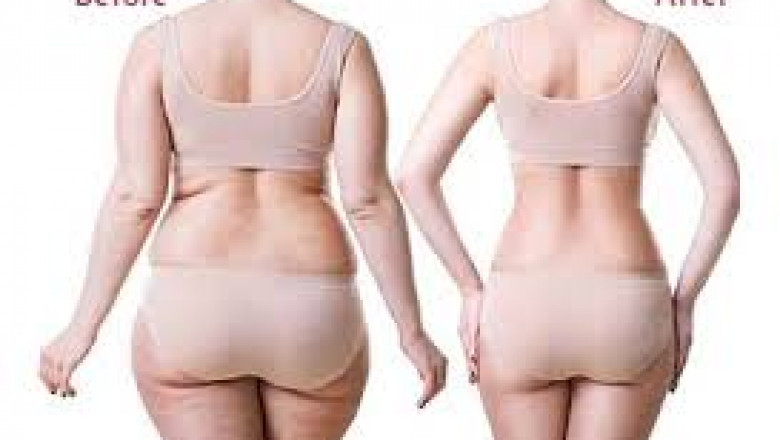 Ultimate Guide to Body Contouring, 6-Pack Abs Surgery, and Liposuction in Gurgaon by Dr. Amit Gupta
