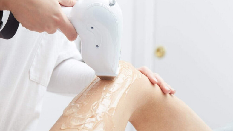 Laser Hair Removal for Brides in Islamabad: Pre-Wedding Guide