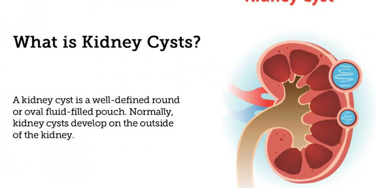 Holistic Kidney Problem Treatment with SRIAAS: Leading the Way in Ayurvedic Care