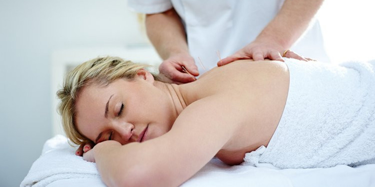 Nurturing Wellness And Fertility Through Acupuncture Therapy