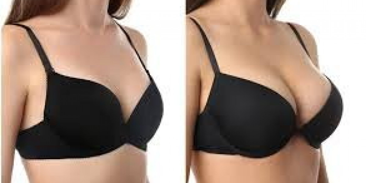 Breast Lift Surgery in Dubai During Different Life Stages: Considerations for Every Age